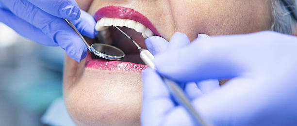 Best Emergency Treatment for Dental Infections or Abscesses in Maytown, PA