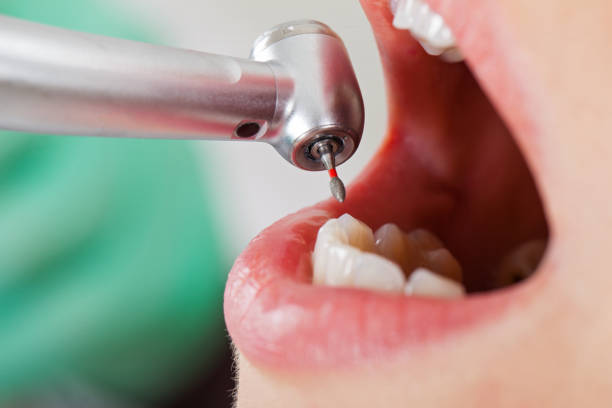 Best Emergency Treatment for Dental Infections or Abscesses in Maytown, PA